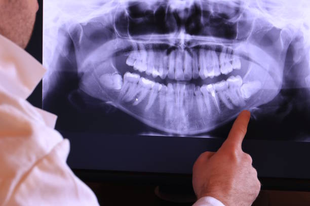 Best Emergency Care for Gum Disease in Madisonville, KY