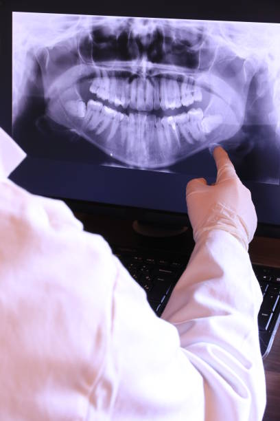 Best Broken or Chipped Tooth Repair in Madisonville, KY